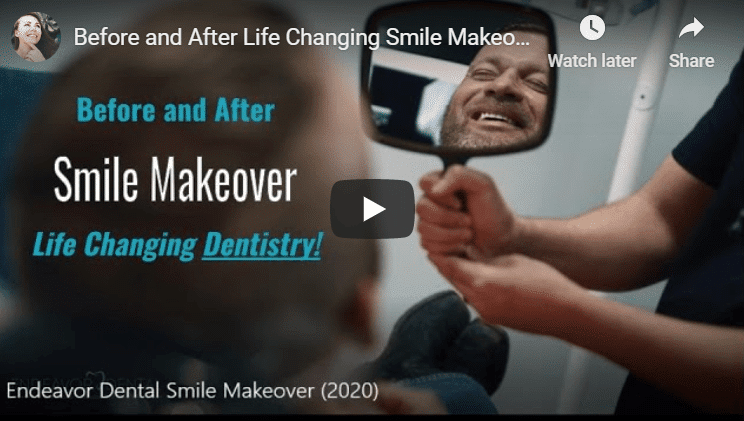Dentist in cibolo smile makeover video